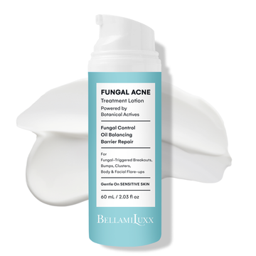Fungal Acne Treatment Lotion: Effective Face & Body Pimple Cream for Bumps, Clusters, Itch & Redness – Fungal Prone Skin Acne Treatment Moisturizer for Teens & Adults with Natural Actives
