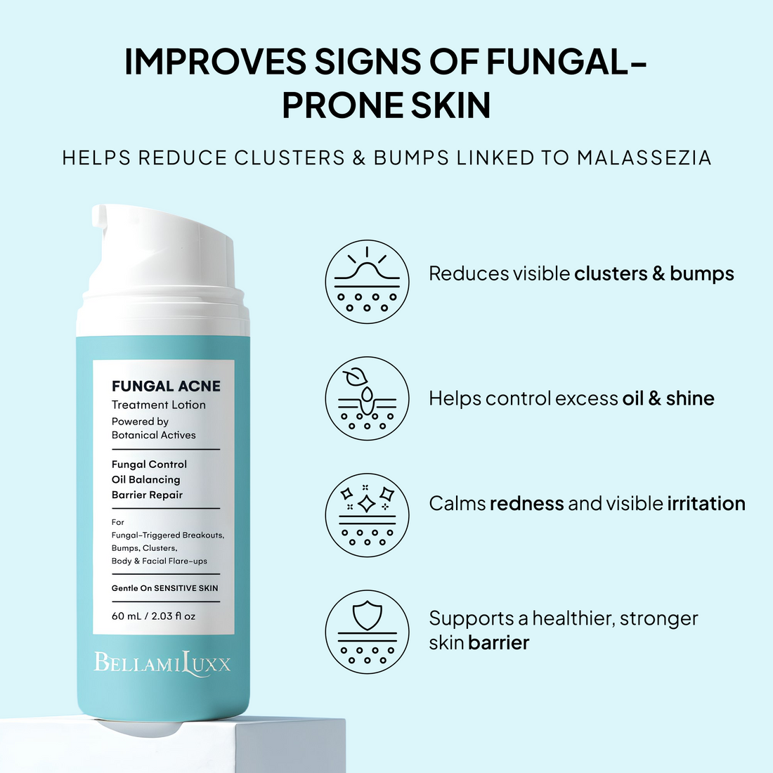 Fungal Acne Treatment Lotion: Effective Face & Body Pimple Cream for Bumps, Clusters, Itch & Redness – Fungal Prone Skin Acne Treatment Moisturizer for Teens & Adults with Natural Actives