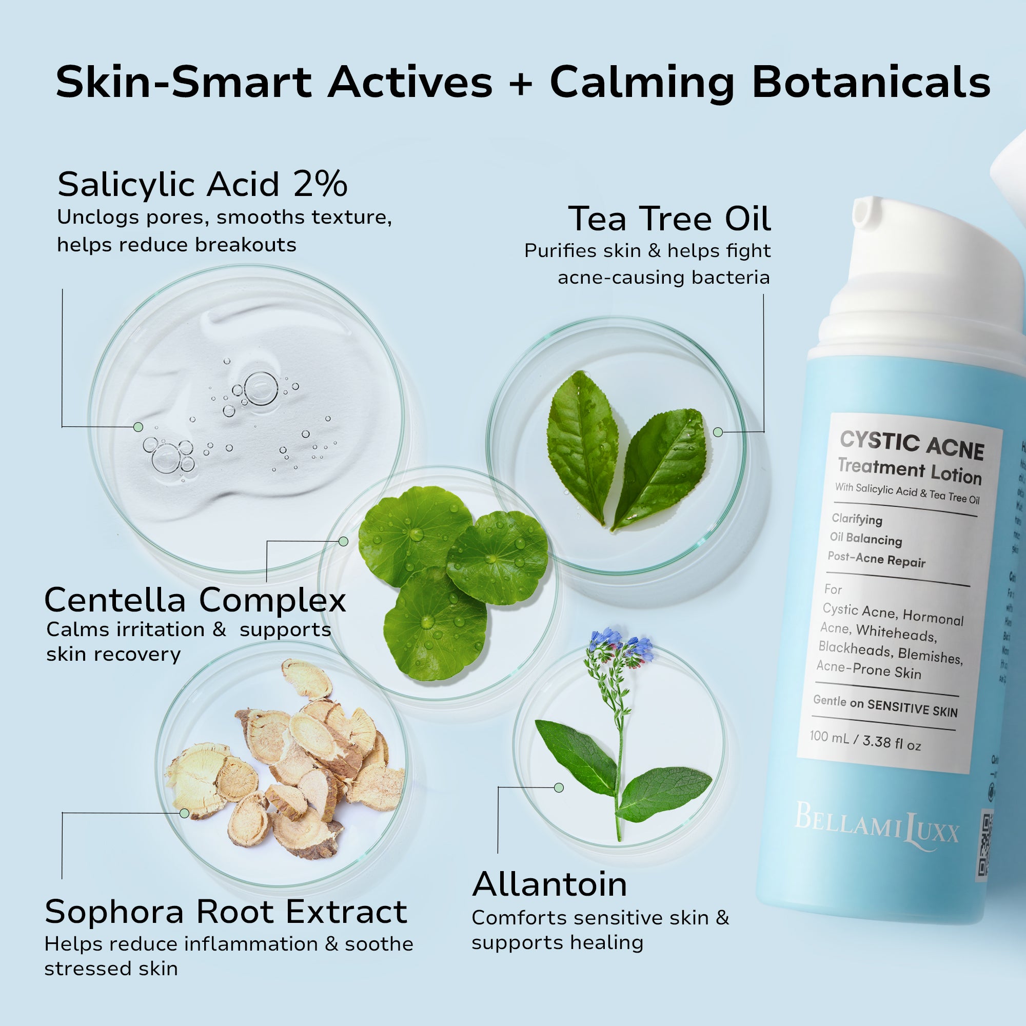 Cystic Acne Treatment for Face: Hormonal Acne Treatment Cream for Teens & Adults - Salicylic Acid & Tea Tree Oil Pimple Spot Remover - Anti-Acne Moisturizer Reduces Redness, Blemishes