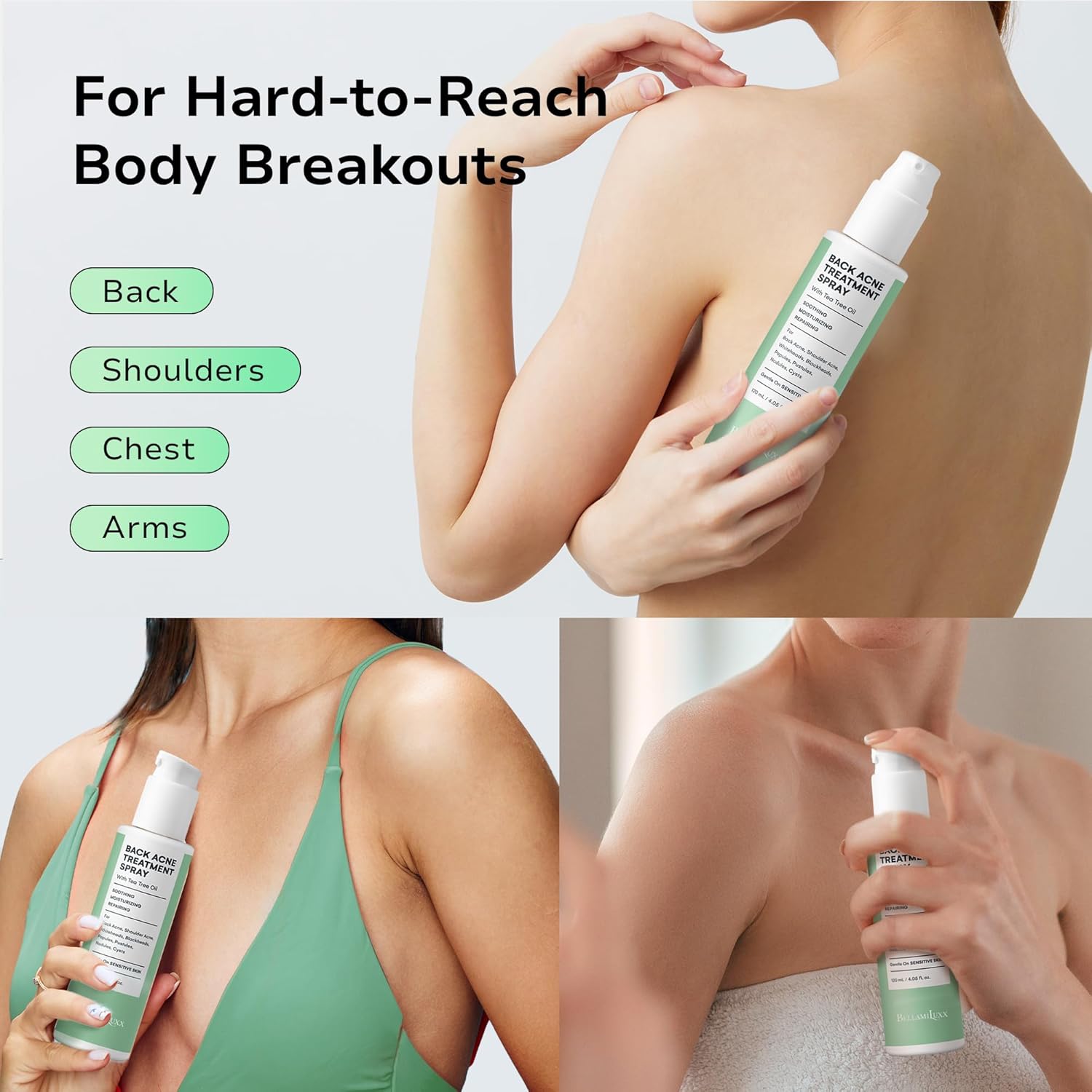 Body Acne Care Set: Butt Acne Treatment Lotion + Back & Body Acne Spray with 2% Salicylic Acid & Tea Tree Oil – Clears Breakouts, Soothes Redness & Prevents Bacne for Men, Women & Teens