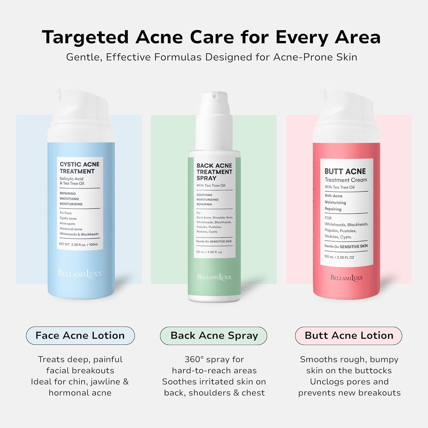 Body Acne Care Set: Butt Acne Treatment Lotion + Back & Body Acne Spray with 2% Salicylic Acid & Tea Tree Oil – Clears Breakouts, Soothes Redness & Prevents Bacne for Men, Women & Teens