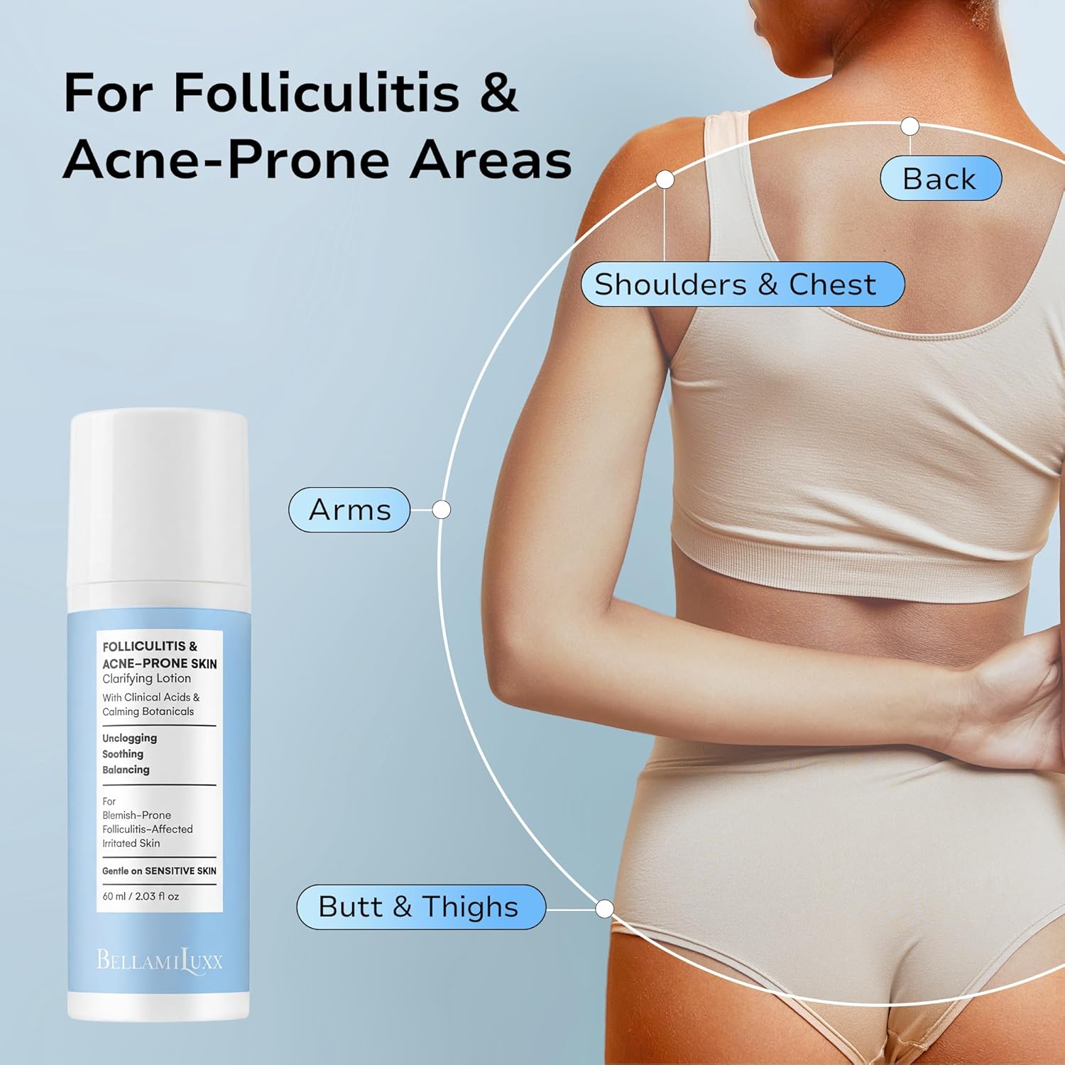Folliculitis Acne Lotion for Body: Helps Reduce Itch, Redness, Body Acne, Bumps & Uneven Texture with Salicylic & Glycolic Acid + Botanicals - Gentle Care for Folliculitis-Prone Skin