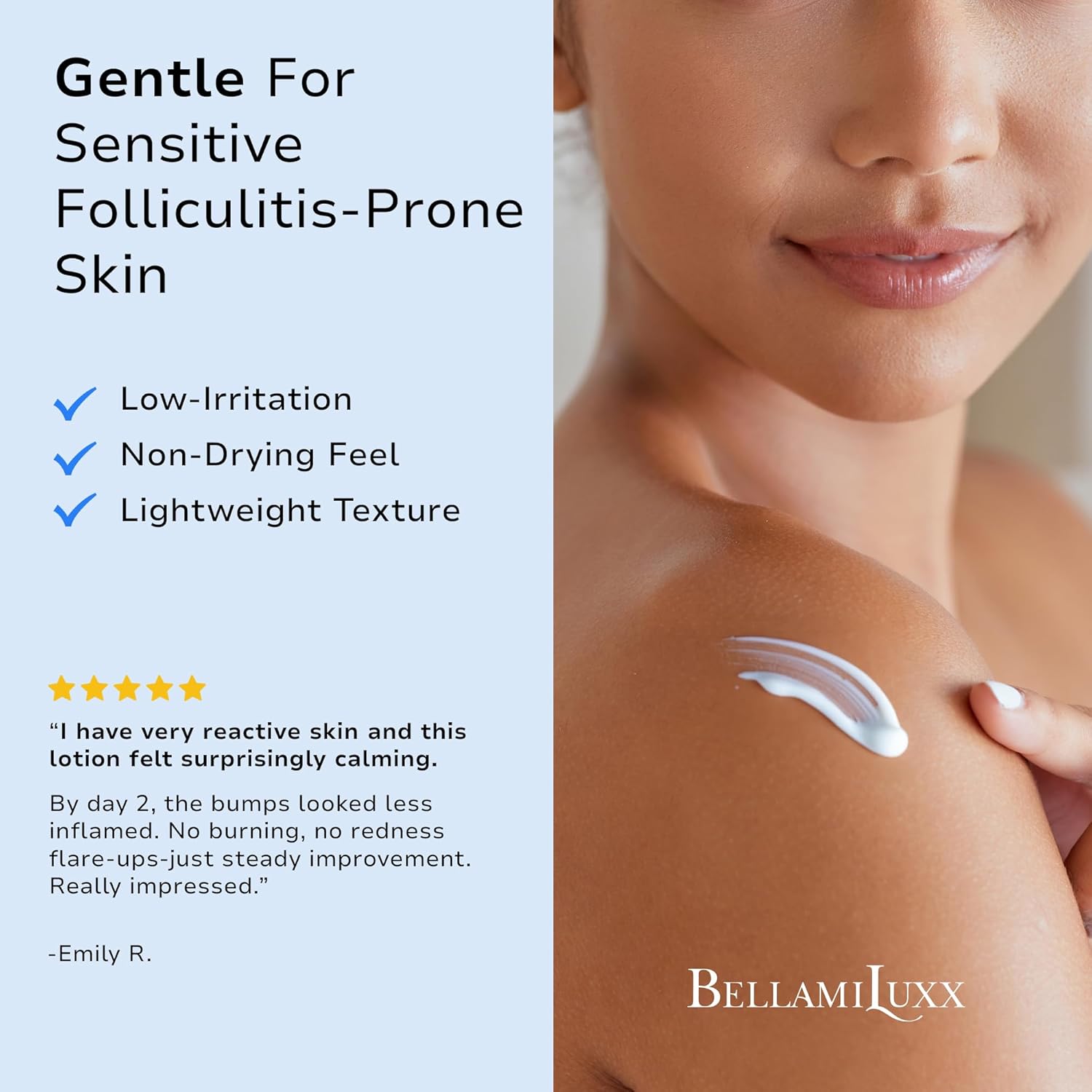 Folliculitis Acne Lotion for Body: Helps Reduce Itch, Redness, Body Acne, Bumps & Uneven Texture with Salicylic & Glycolic Acid + Botanicals - Gentle Care for Folliculitis-Prone Skin