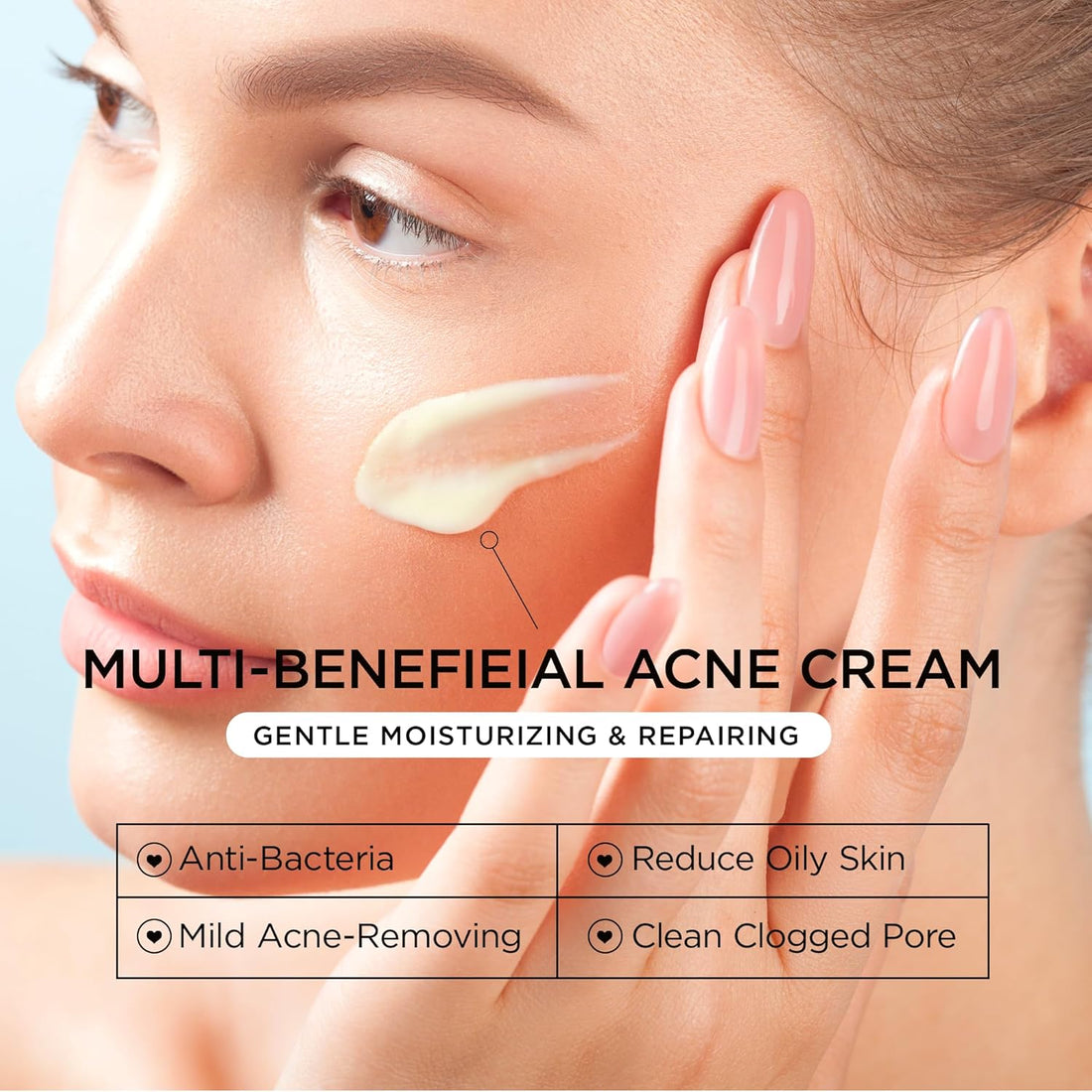 Cystic Acne Treatment for Face: Hormonal Acne Treatment Cream for Teens & Adults - Salicylic Acid & Tea Tree Oil Pimple Spot Remover - Anti-Acne Moisturizer Reduces Redness, Blemishes