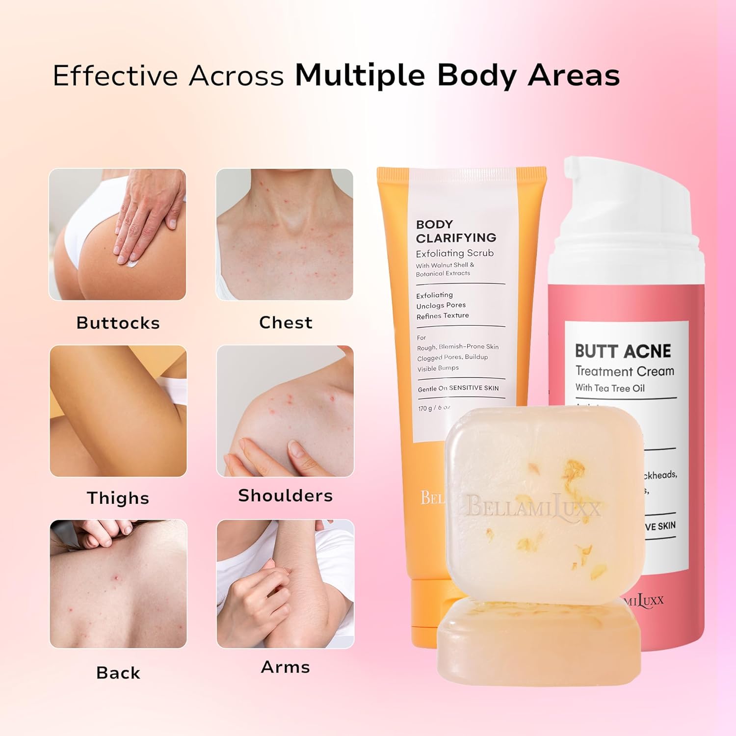 Butt Acne Clearing Set: Butt Acne Lotion + Acne Soap + Body Acne Scrub for Breakouts on Butt, Thighs, Back & Chest, KP Bumps, Clogged Pores & Rough Buttocks – Exfoliate, Cleanse & Smooth