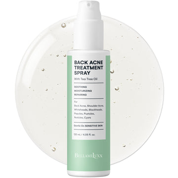 Back & Body Acne Treatment Spray, 4.05 fl. oz / 120 mL