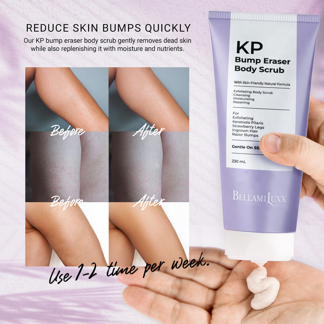 KP Bump Eraser Body Scrub: Exfoliating Keratosis Pilaris, Strawberry Skin Treatment - Smooths Rough, Bumpy, Dry Skin on Arms, Legs, Buttocks - KP Scrub Wash Helps Reduce Ingrown Hair Bumps